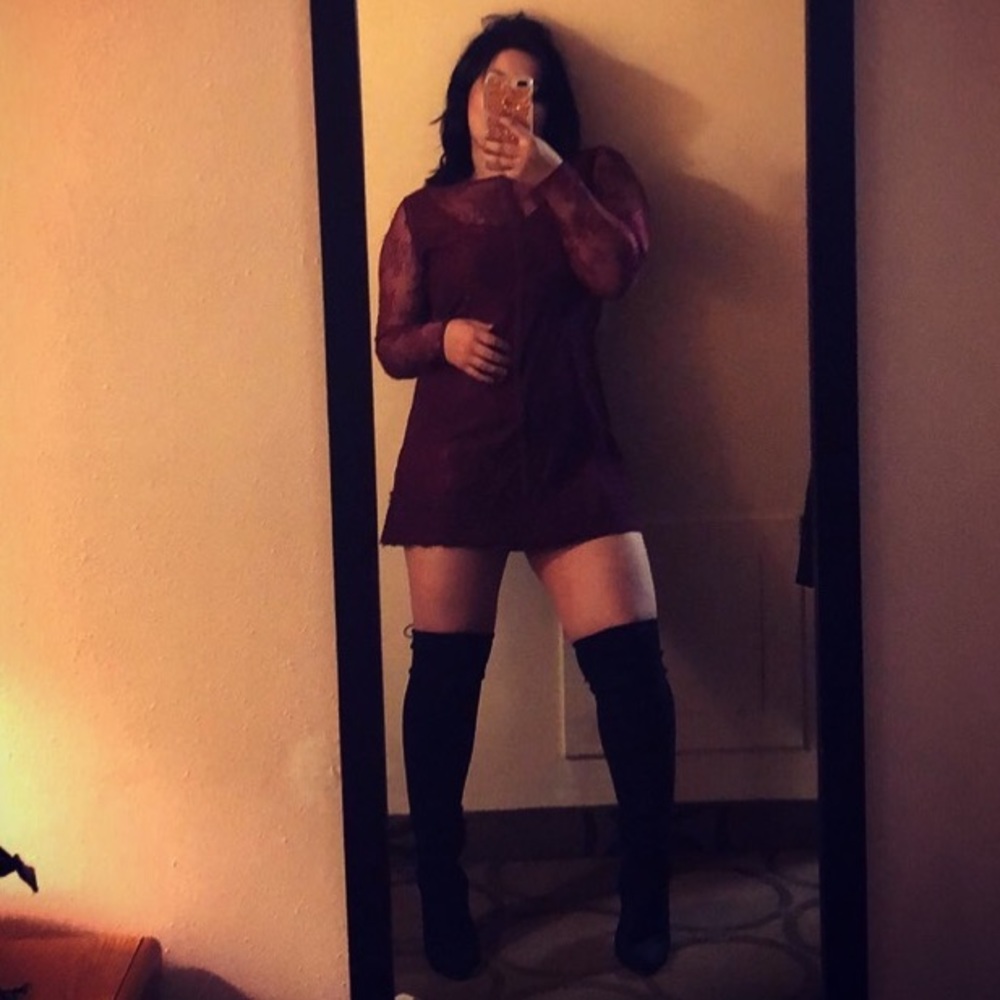 Guess lace mini dress - Picture 2 of 4